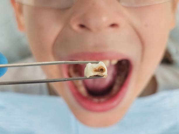 Best Emergency Denture Repair in Encinal, TX
